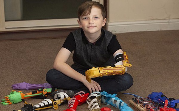 感動！英父親為無臂兒子3D打印9只個性仿生臂