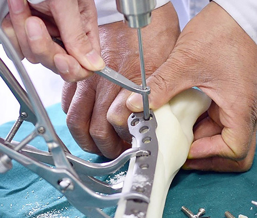 3D打印技術在骨科的實際應用有哪些？(圖2)