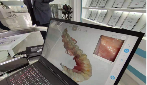  3D打印技術(shù)在牙科義齒領(lǐng)域中牙套制作的應(yīng)用是怎樣的呢？(圖2)